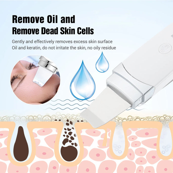 Ultrasonic Derma Skin Scrubber Pen