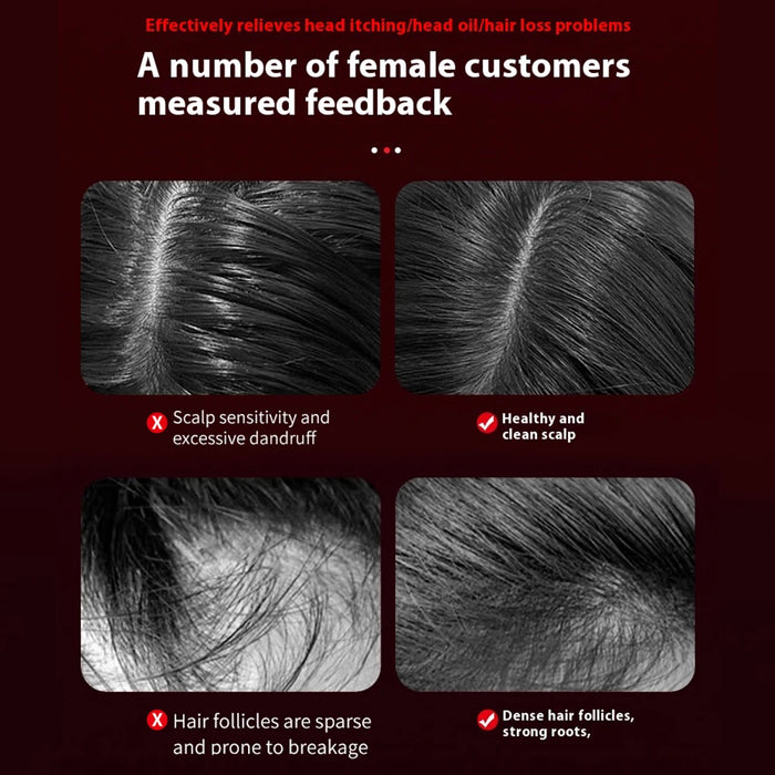 Red Light Scalp Massager Comb with Vibration and Serum Applicator – 3 Modes Rechargeable Hair Care Brush On Sale